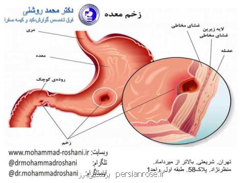 ورم معده